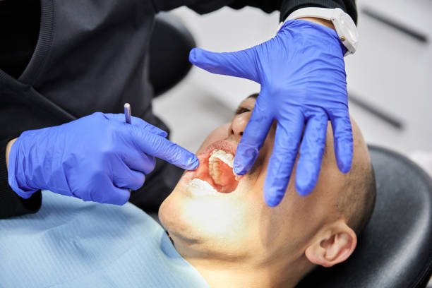Best Knocked-Out Tooth (Avulsed Tooth) Treatment in Youngsville, NC